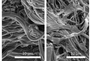 Biobasiertes Verbundmaterial - Wie Elastin für die Haut