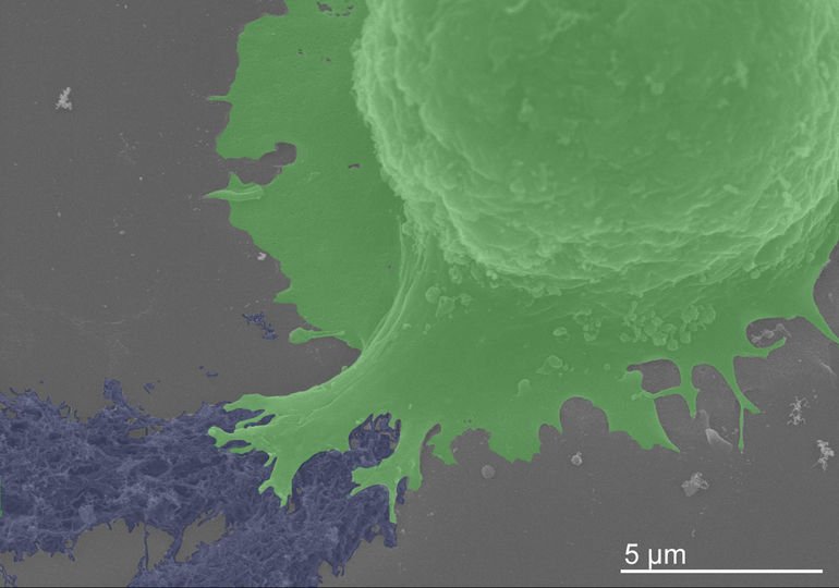 Nanofibrillen als Klettergerüst für Nervenzellen