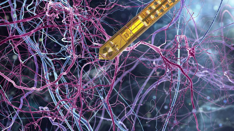 High_detailed_realistic_3D_render_of_super_macro_close-up_view_of_neurones_inside_of_human_brain