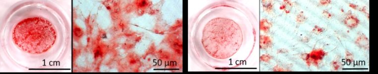 Tissue Engineering: Stammzellen zur Knochenzellbildung anregen