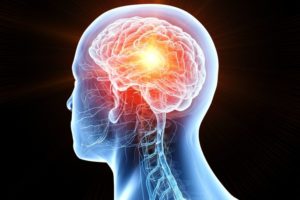 Prognose Tumor Gehirn Bildungsmethoden uniklinik köln