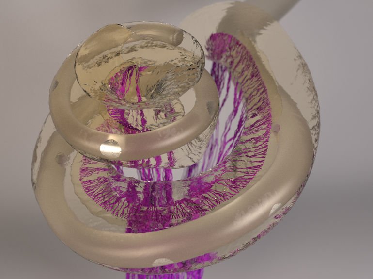 Cochlea Implantat TU München Computermodell