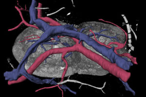 3D-Bilder zeigen, wie Lymphknoten mit Blut versorgt werden