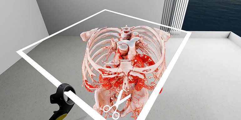 In Echtzeit vom CT in 3D