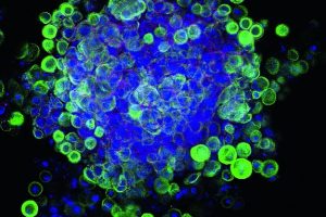 Umprogrammierbare Hautstammzellen aus der Petrischale