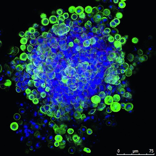 Umprogrammierbare Hautstammzellen aus der Petrischale