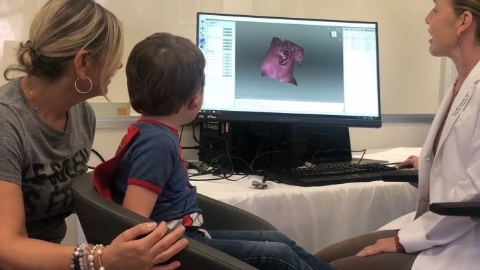 3D-Scanner ermöglicht schonende Ohrrekonstruktion für Mikrotie-Patienten