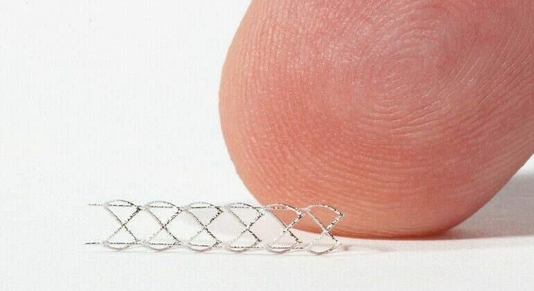 FIT_New-Gen-Stent.jpg