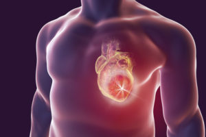 Herzinfarkt: Kommunikationssystem für smarte Implantate