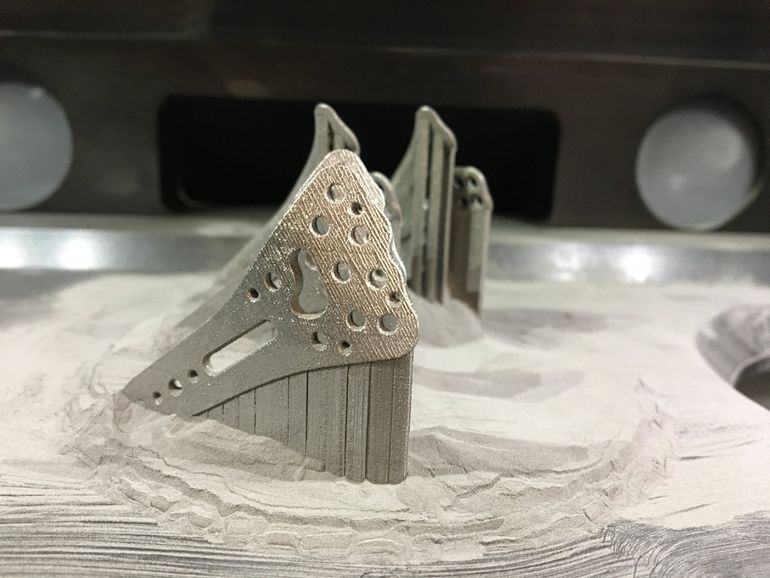 Amorphe Implantate aus dem 3D-Drucker