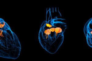 Studie: Herzklappen aus Eigengewebe beim Menschen