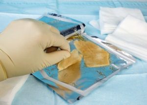 Nurse_selects_sterile_hydrogel_dressing_for_use_on_a_burn_or_wound.