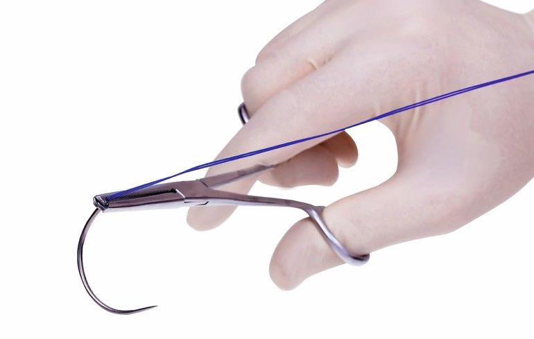 surgical__forceps__holding_a_suture_needle