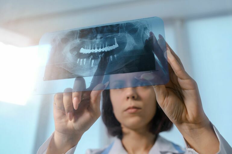Close_up_picture_of_young_woman_doctor_dentist_who_analysis_dental_x_ray_orthopantomogram._Dental_panoramic_radiography